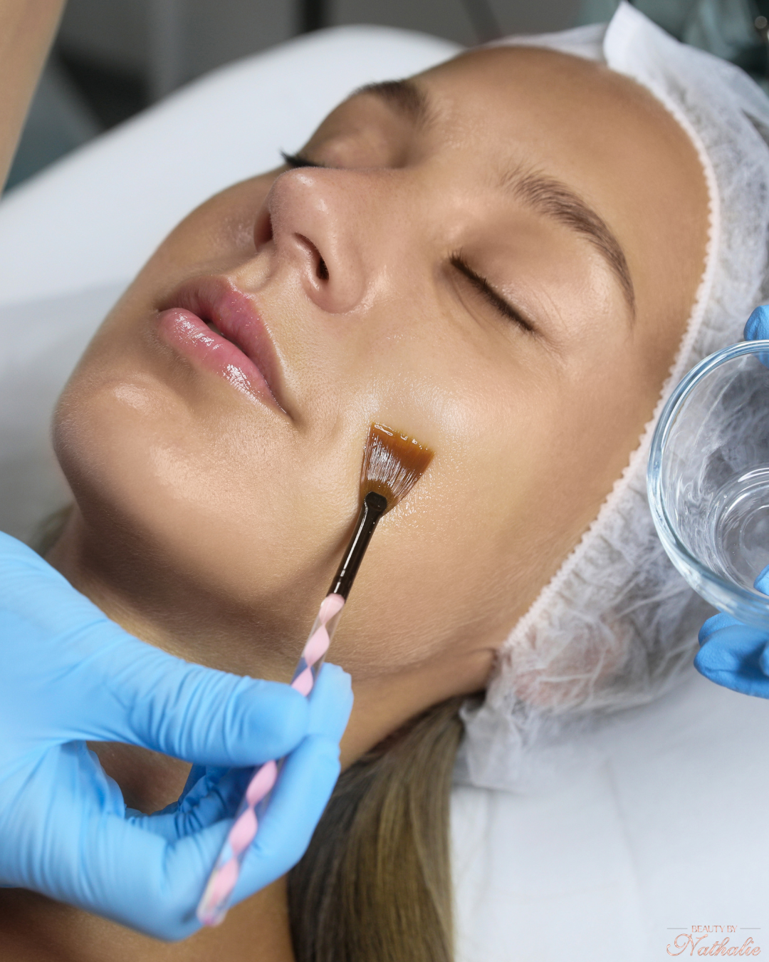 Kemisk Peeling (AHA / Lactic / Glycolic)